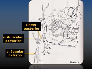 Ramo 
posterior 
v. Auricular 
posterior 
v. Jugular 
externa 
Madeira 
 