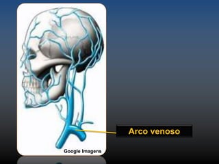Arco venoso 
Google Imagens 
 