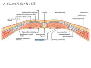 ARTÉRIA EPIGÁSTRICA INFERIOR
 