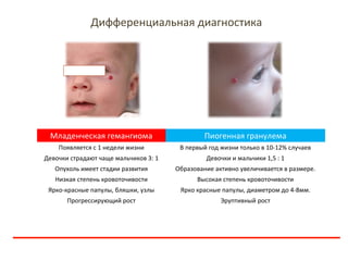 Младенческая гемангиома Пиогенная гранулема
Появляется с 1 недели жизни В первый год жизни только в 10-12% случаев
Девочки...
