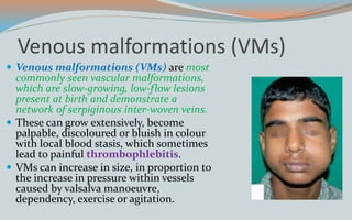 Venous malformations (VMs)
 Venous malformations (VMs) are most
commonly seen vascular malformations,
which are slow-growing, low-flow lesions
present at birth and demonstrate a
network of serpiginous inter-woven veins.
 These can grow extensively, become
palpable, discoloured or bluish in colour
with local blood stasis, which sometimes
lead to painful thrombophlebitis.
 VMs can increase in size, in proportion to
the increase in pressure within vessels
caused by valsalva manoeuvre,
dependency, exercise or agitation.
 
