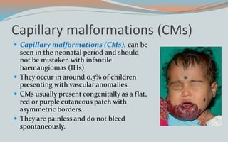 Capillary malformations (CMs)
 Capillary malformations (CMs), can be
seen in the neonatal period and should
not be mistaken with infantile
haemangiomas (IHs).
 They occur in around 0.3% of children
presenting with vascular anomalies.
 CMs usually present congenitally as a flat,
red or purple cutaneous patch with
asymmetric borders.
 They are painless and do not bleed
spontaneously.
 