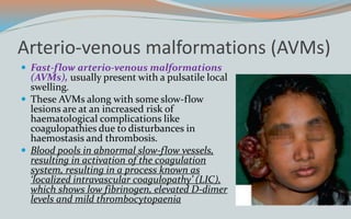 Arterio-venous malformations (AVMs)
 Fast-flow arterio-venous malformations
(AVMs), usually present with a pulsatile local
swelling.
 These AVMs along with some slow-flow
lesions are at an increased risk of
haematological complications like
coagulopathies due to disturbances in
haemostasis and thrombosis.
 Blood pools in abnormal slow-flow vessels,
resulting in activation of the coagulation
system, resulting in a process known as
‘localized intravascular coagulopathy’ (LIC),
which shows low fibrinogen, elevated D-dimer
levels and mild thrombocytopaenia
 