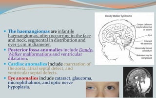  The haemangiomas are infantile
haemangiomas, often occurring in the face
and neck, segmental in distribution and
over 5 cm in diameter.
 Posterior fossa anomalies include Dandy-
Walker malformations and ventricular
dilatation.
 Cardiac anomalies include coarctation of
the aorta, atrial septal defect, and
ventricular septal defects.
 Eye anomalies include cataract, glaucoma,
microphthalmos, and optic nerve
hypoplasia.
 