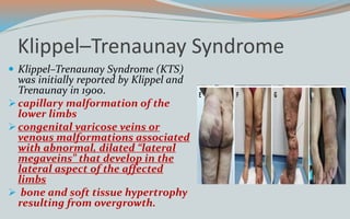 Klippel–Trenaunay Syndrome
 Klippel–Trenaunay Syndrome (KTS)
was initially reported by Klippel and
Trenaunay in 1900.
capillary malformation of the
lower limbs
congenital varicose veins or
venous malformations associated
with abnormal, dilated “lateral
megaveins” that develop in the
lateral aspect of the affected
limbs
 bone and soft tissue hypertrophy
resulting from overgrowth.
 