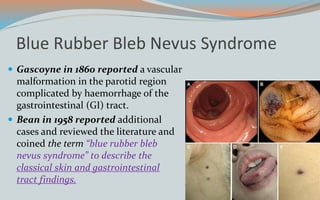 Blue Rubber Bleb Nevus Syndrome
 Gascoyne in 1860 reported a vascular
malformation in the parotid region
complicated by haemorrhage of the
gastrointestinal (GI) tract.
 Bean in 1958 reported additional
cases and reviewed the literature and
coined the term “blue rubber bleb
nevus syndrome” to describe the
classical skin and gastrointestinal
tract findings.
 