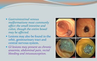  Gastrointestinal venous
malformations most commonly
affect the small intestine and
colon, though the entire bowel
may be affected.
 Lesions may also be found in the
orbit, genitourinary tract and
central nervous system.
 GI lesions may present as chronic
anaemia, abdominal pain, rectal
bleeding and intussusception.
 
