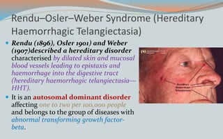 Rendu–Osler–Weber Syndrome (Hereditary
Haemorrhagic Telangiectasia)
 Rendu (1896), Osler 1901) and Weber
(1907)described a hereditary disorder
characterised by dilated skin and mucosal
blood vessels leading to epistaxis and
haemorrhage into the digestive tract
(hereditary haemorrhagic telangiectasia—
HHT).
 It is an autosomal dominant disorder
affecting one to two per 100,000 people
and belongs to the group of diseases with
abnormal transforming growth factor-
beta.
 
