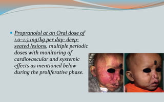  Propranolol at an Oral dose of
1.0–1.5 mg/kg per day- deep-
seated lesions, multiple periodic
doses with monitoring of
cardiovascular and systemic
effects as mentioned below
during the proliferative phase.
 