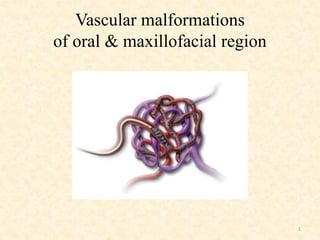 Vascular malformations
of oral & maxillofacial region
1
 