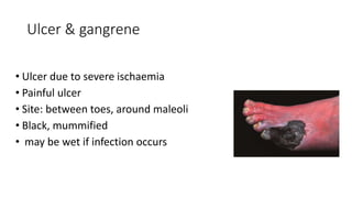 Ulcer & gangrene
• Ulcer due to severe ischaemia
• Painful ulcer
• Site: between toes, around maleoli
• Black, mummified
• may be wet if infection occurs
 