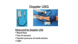 Doppler USG
Measured by Doppler USG
Blood flow
Site of stenosis
Systolic pressure of small arteries
ABPI
 