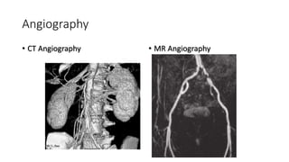 Angiography
• CT Angiography • MR Angiography
 