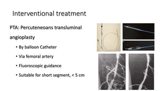 Interventional treatment
PTA: Percuteneoans transluminal
angioplasty
• By balloon Catheter
• Via femoral artery
• Fluoroscopic guidance
• Suitable for short segment, < 5 cm
 