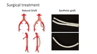 Surgical treatment
Natural Graft Synthetic graft
 