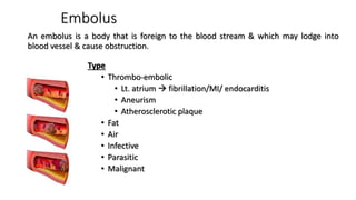 Embolus
An embolus is a body that is foreign to the blood stream & which may lodge into
blood vessel & cause obstruction.
Type
• Thrombo-embolic
• Lt. atrium  fibrillation/MI/ endocarditis
• Aneurism
• Atherosclerotic plaque
• Fat
• Air
• Infective
• Parasitic
• Malignant
 
