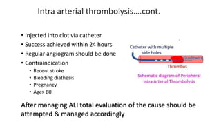 Intra arterial thrombolysis….cont.
• Injected into clot via catheter
• Success achieved within 24 hours
• Regular angiogram should be done
• Contraindication
• Recent stroke
• Bleeding diathesis
• Pregnancy
• Age> 80
After managing ALI total evaluation of the cause should be
attempted & managed accordingly
 