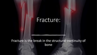 Fracture:
Fracture is the break in the structural continuity of
bone
 