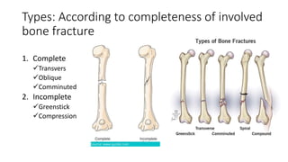 Types: According to completeness of involved
bone fracture
1. Complete
Transvers
Oblique
Comminuted
2. Incomplete
Greenstick
Compression
 