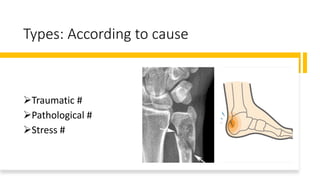 Types: According to cause
Traumatic #
Pathological #
Stress #
 
