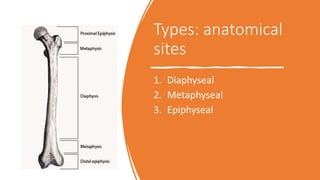 Types: anatomical
sites
1. Diaphyseal
2. Metaphyseal
3. Epiphyseal
 
