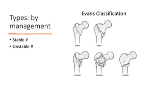 Types: by
management
• Stable #
• Unstable #
 