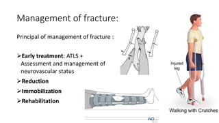 Management of fracture:
Principal of management of fracture :
Early treatment: ATLS +
Assessment and management of
neurovascular status
Reduction
Immobilization
Rehabilitation
 