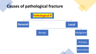Pathological #
General Local
Benign Malignant
Primary
Secondary
Causes of pathological fracture
 