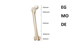 Bone
tumour
EG
MO
DE
 