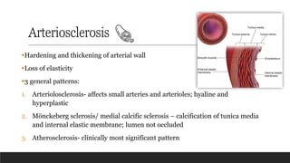 Arteriosclerosis
▪Hardening and thickening of arterial wall
▪Loss of elasticity
▪3 general patterns:
1. Arteriolosclerosis- affects small arteries and arterioles; hyaline and
hyperplastic
2. Mönckeberg sclerosis/ medial calcific sclerosis – calcification of tunica media
and internal elastic membrane; lumen not occluded
3. Atherosclerosis- clinically most significant pattern
 