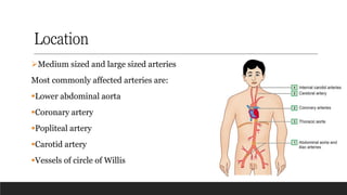 Location
➢Medium sized and large sized arteries
Most commonly affected arteries are:
▪Lower abdominal aorta
▪Coronary artery
▪Popliteal artery
▪Carotid artery
▪Vessels of circle of Willis
 