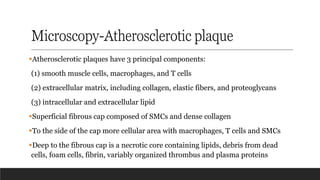 Microscopy-Atherosclerotic plaque
▪Atherosclerotic plaques have 3 principal components:
(1) smooth muscle cells, macrophages, and T cells
(2) extracellular matrix, including collagen, elastic fibers, and proteoglycans
(3) intracellular and extracellular lipid
▪Superficial fibrous cap composed of SMCs and dense collagen
▪To the side of the cap more cellular area with macrophages, T cells and SMCs
▪Deep to the fibrous cap is a necrotic core containing lipids, debris from dead
cells, foam cells, fibrin, variably organized thrombus and plasma proteins
 