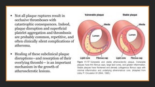 ▪ Not all plaque ruptures result in
occlusive thromboses with
catastrophic consequences. Indeed,
plaque disruption and superficial
platelet aggregation and thrombosis
are probably common, repetitive, and
often clinically silent complications of
atheroma.
▪ Healing of these subclinical plaque
disruptions—and resorption of their
overlying thrombi— is an important
mechanism in the growth of
atherosclerotic lesions.
 