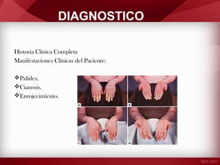 DIAGNOSTICO
Historia Clínica Completa
Manifestaciones Clínicas del Paciente:
Palidez.
Cianosis.
Enrojecimiento.

 