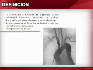 La Enfermedad ó Arteritis de Takayasu es una
enfermedad inflamatoria inespecífica de etiología
desconocida que afecta a la aorta y a sus ramificaciones.
Se observa con mayor frecuencia en las mujeres jóvenes,
especialmente de raza asiática.
Edad promedio de 25 años.

 