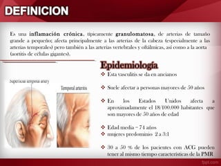 Es una inflamación crónica , típicamente granulomatosa, de arterias de tamaño
grande a pequeño; afecta principalmente a las arterias de la cabeza (especialmente a las
arterias temporales) pero también a las arterias vertebrales y oftálmicas, así como a la aorta
(aortitis de células gigantes).

 
