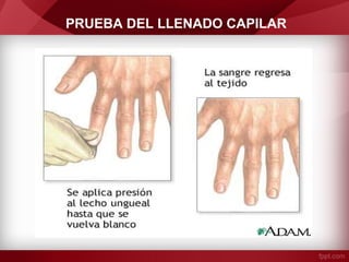 PRUEBA DEL LLENADO CAPILAR

 