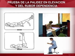 PRUEBA DE LA PALIDEZ EN ELEVACION
Y DEL RUBOR DEPENDENCIA

 