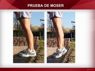 PRUEBA DE MOSER

 