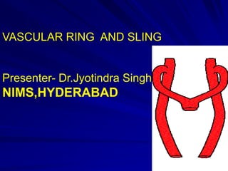 VASCULAR RING AND SLING

Presenter- Dr.Jyotindra Singh

NIMS,HYDERABAD

 