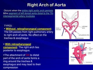 Right Arch of Aorta
Occurs when the entire right aortic arch persists
&the segment of left dorsal aorta distal to the 7th
intersegmental artery involutes

TYPES:

 Without retropharyngeal component:
The DA passes from right pulmonary artery
to right arch of aorta. No effect on the
trachea & esophagus
 With retropharyngeal
component: The right arch lies
posterior to esophagus.
The attachment of DA to distal
part of the arch of aorta forms a
ring around the trachea &
esophagus and may lead to their
compression

 