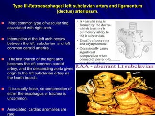 Type III-Retroesophageal left subclavian artery and ligamentum
(ductus) arteriosum.
Most common type of vascular ring
associated with right arch.

Interruption of the left arch occurs
between the left subclavian and left
common carotid arteries .
The first branch of the right arch
becomes the left common carotid
artery, and the descending aorta gives
origin to the left subclavian artery as
the fourth branch.
It is usually loose, so compression of
either the esophagus or trachea is
uncommon.
Associated cardiac anomalies are
rare.

 