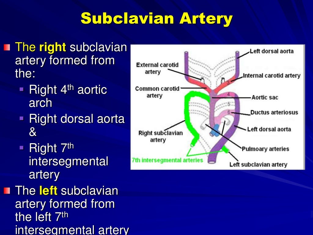 Vascular ring and sling