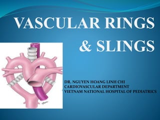 VASCULAR RINGS
& SLINGS
DR. NGUYEN HOANG LINH CHI
CARDIOVASCULAR DEPARTMENT
VIETNAM NATIONAL HOSPITAL OF PEDIATRICS
 