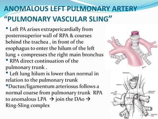 Vascular ring & Sling | PPTX