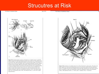 Strucutres at Risk
10
 