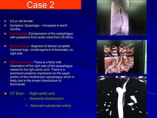 Case 2
9.5 yr old female.
Symptom- Dysphagia – Increased in last 6
months.
Gastroscopy -Compression of the oesophagus
with pulsations from aorta noted from 25-30cm.
Bronchoscopy -Segment of almost complete
tracheal rings - small segment of trachealis, on
right side
Barium swallow - There is a fairly mild
indentation of the right side of the oesophagus
related to the right aortic arch. There is a
prominent posterior impression on the upper
portion of the intrathoracic oesophagus which is
likely due to the known diverticulum of
Kommerell.
CT Scan - Right aortic arch
- Komerrel diverticulum
- Aberrant subclavian artery
12
 