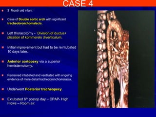 CASE 4
3 Month old infant
Case of Double aortic arch with significant
tracheobronchomalacia.
Left thoracotomy - Division of ductus+
plication of kommerels diverticulum.
Initial improvement but had to be reintubated
10 days later.
Anterior aortopexy via a superior
hemisternotomy.
Remained intubated and ventilated with ongoing
evidence of more distal tracheobronchomalacia.
Underwent Posterior tracheopexy.
Extubated 6th postop day – CPAP- High
Flows – Room air.
 