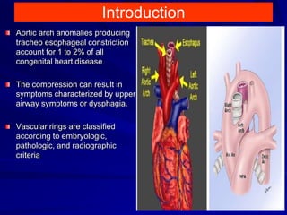 Introduction
Aortic arch anomalies producing
tracheo esophageal constriction
account for 1 to 2% of all
congenital heart disease
The compression can result in
symptoms characterized by upper
airway symptoms or dysphagia.
Vascular rings are classified
according to embryologic,
pathologic, and radiographic
criteria
2
 