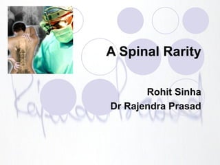 A Spinal Rarity
Rohit Sinha
Dr Rajendra Prasad
 